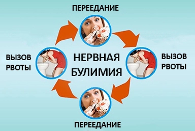 Лечение булимии в Мурманске
